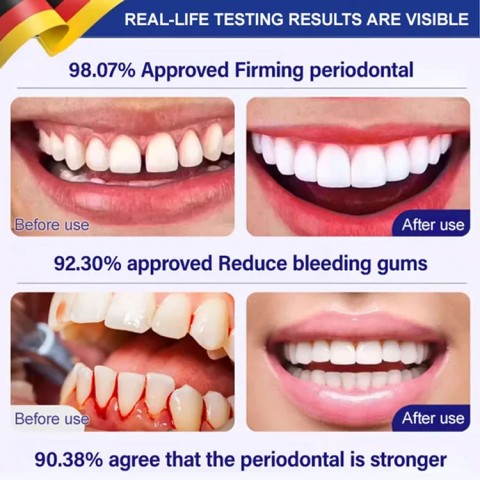 Desensitizing teeth gel