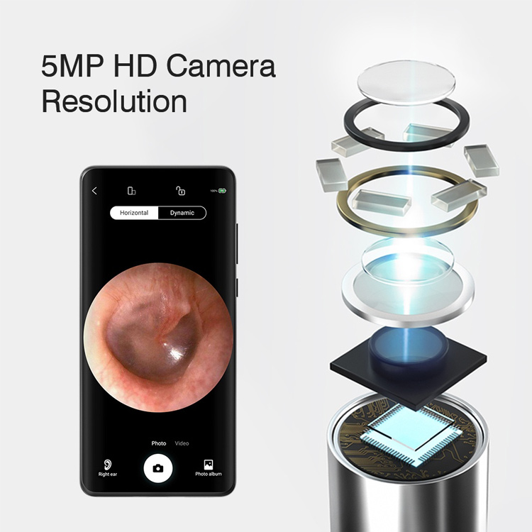 7.7 Super Sale - German Smart HD Camera Visual Ear Cleaner - Painless. Avoid ear canal damage. 1 year warranty